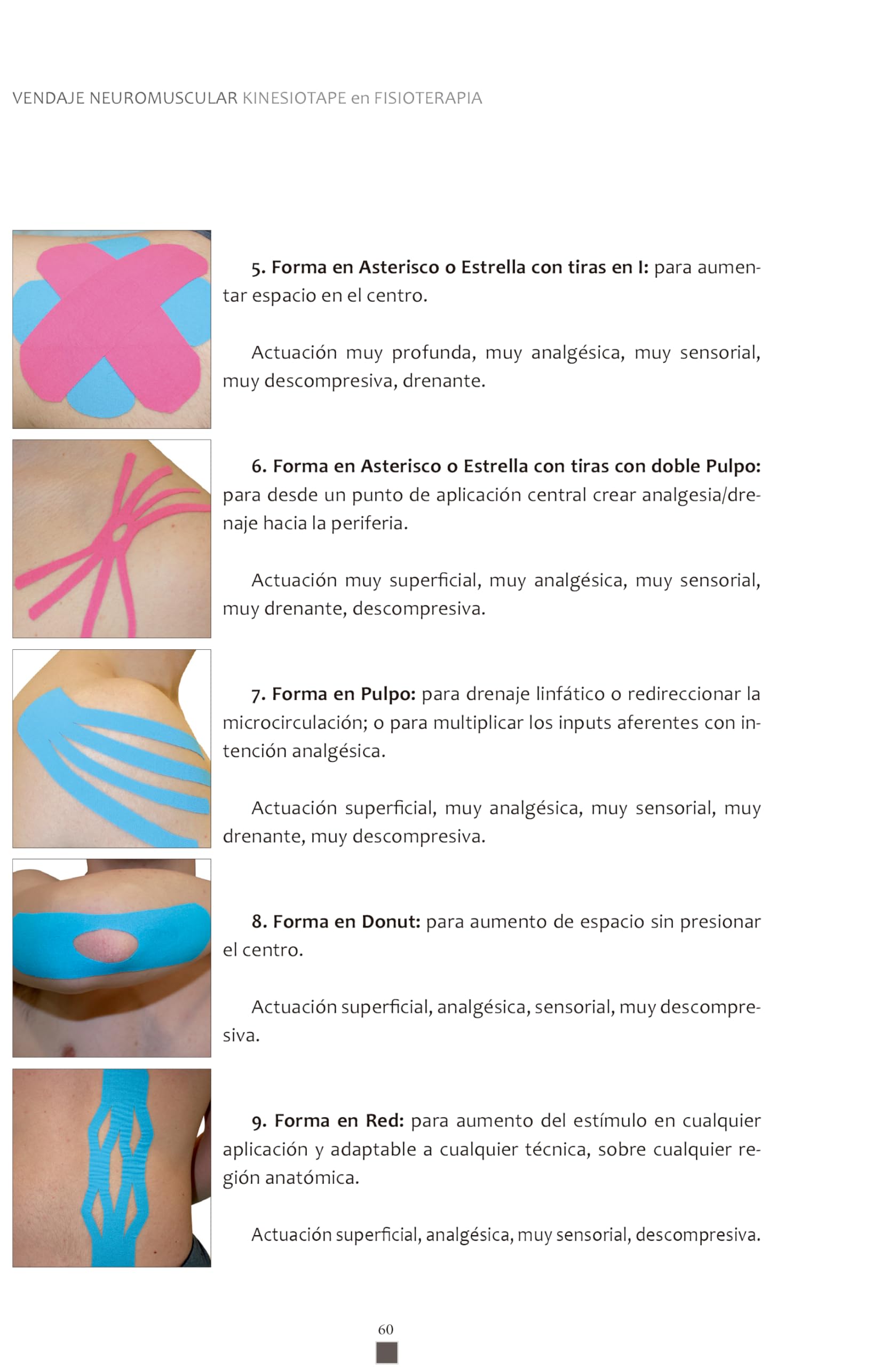 VENDAJE NEUROMUSCULAR KINESIOTAPE EN FISIOTERAPIA