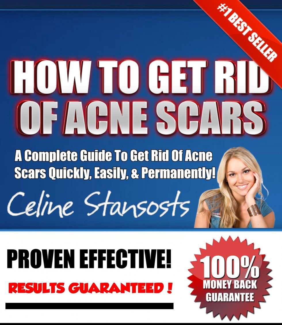 Amazon.com: How To Get Rid Of Acne Scars! – The #1 Best Guide To ...