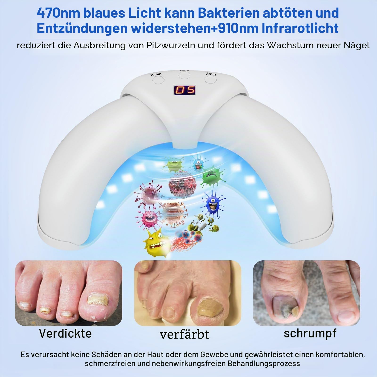 Nagelpilz-Reinigungsgerät, faltbares Nagelpilz-Lichtgerät für mehrere Finger- und Fußnägel, verfärbte und verdickte Zehennägel, einfache und effektive Behandlung zu Hause