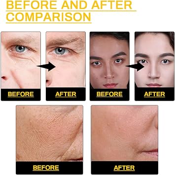 skin care for men taro face facial stimulator taro balm for men natural skin care day and night face facial moisturizer for men skin care kit