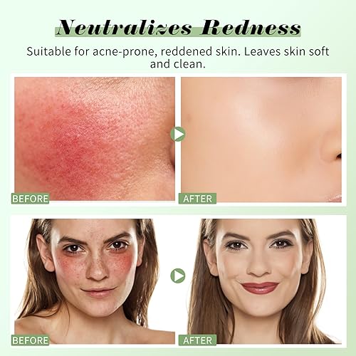 Miniatura 5 de Crema hidratante teñida con crema correctora, imprimación de maquillaje para un lienzo impecable y suave, formulado con centella asiática y vitamina