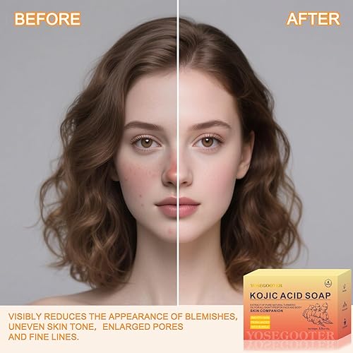 Miniatura 6 de Barras de jabón de ácido kójico de cúrcuma, removedor de manchas oscuras para rostro y cuerpo, barra de jabón de cúrcuma para iluminar e hidratar