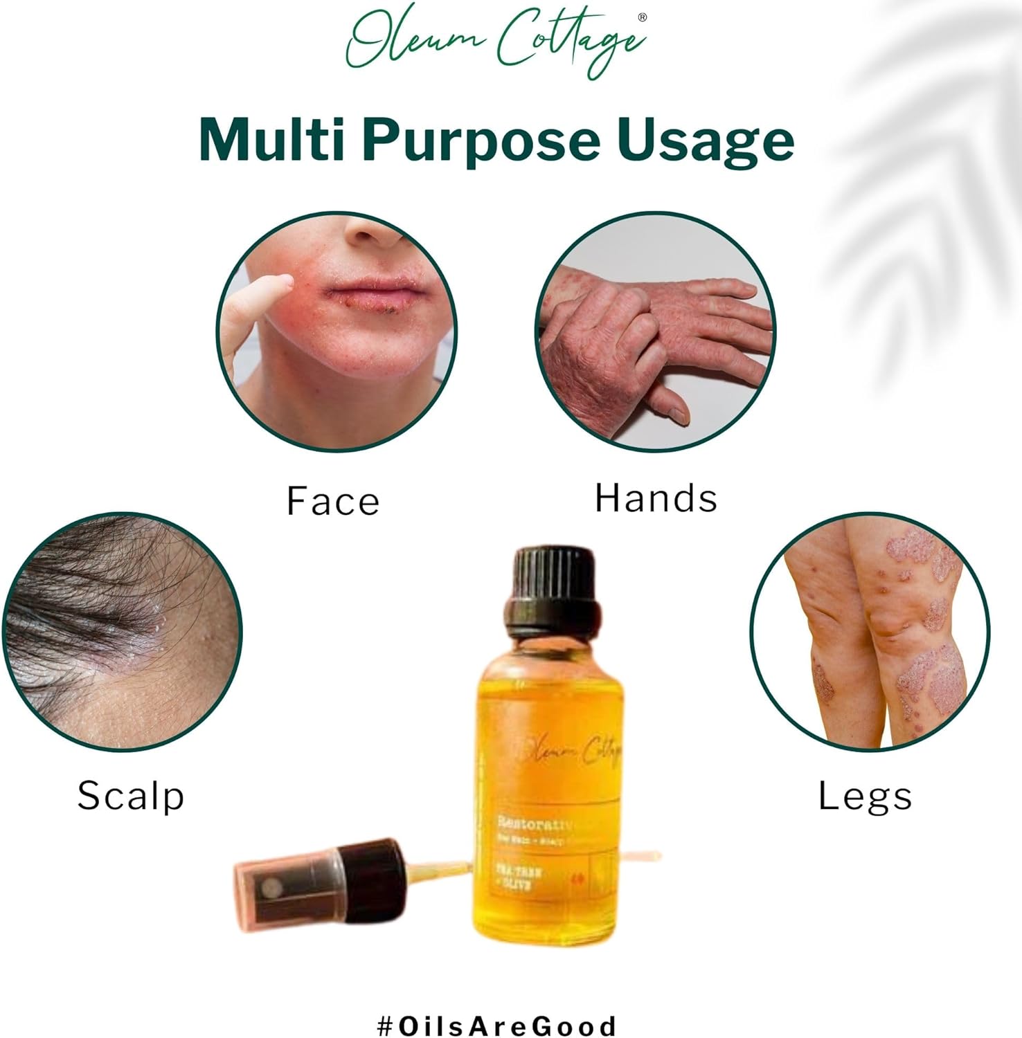 Restorative Oil for Skin + Scalp 50 Ml 50 Ml (Pack of 1)