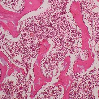 Mammal Bone Marrow sec. 7 m H&E Microscope Slide