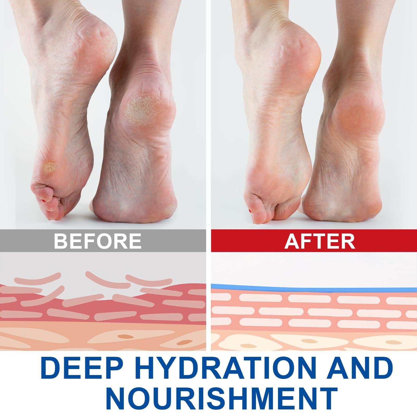 2PCS Urea Cream 60 Percent for Feet with Salicylic Acid, Intensive Callus & Hard Skin Remover, Cracked Heel Repair Balm - Image 4