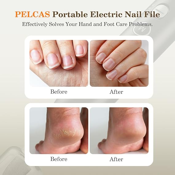 PELCAS Electric Nail Grinder, 10 Speeds Cordless Nail Drill with LED Light