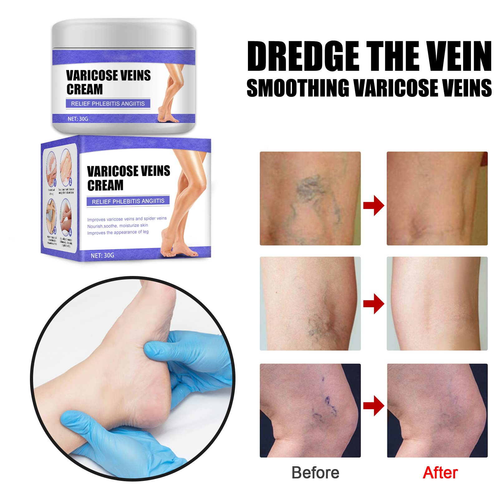 Crème Pour Varices Grocerism 50g – Extrait De Grenade, Soin Des Jambes | Traitement Veines Naturel