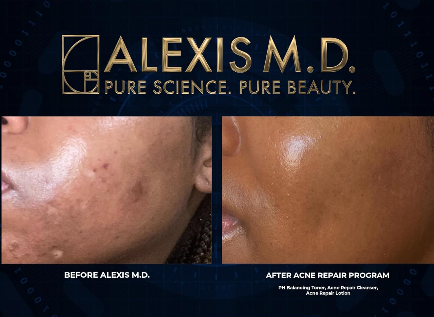 PH Balancing Toner | 100ml | 3.3oz