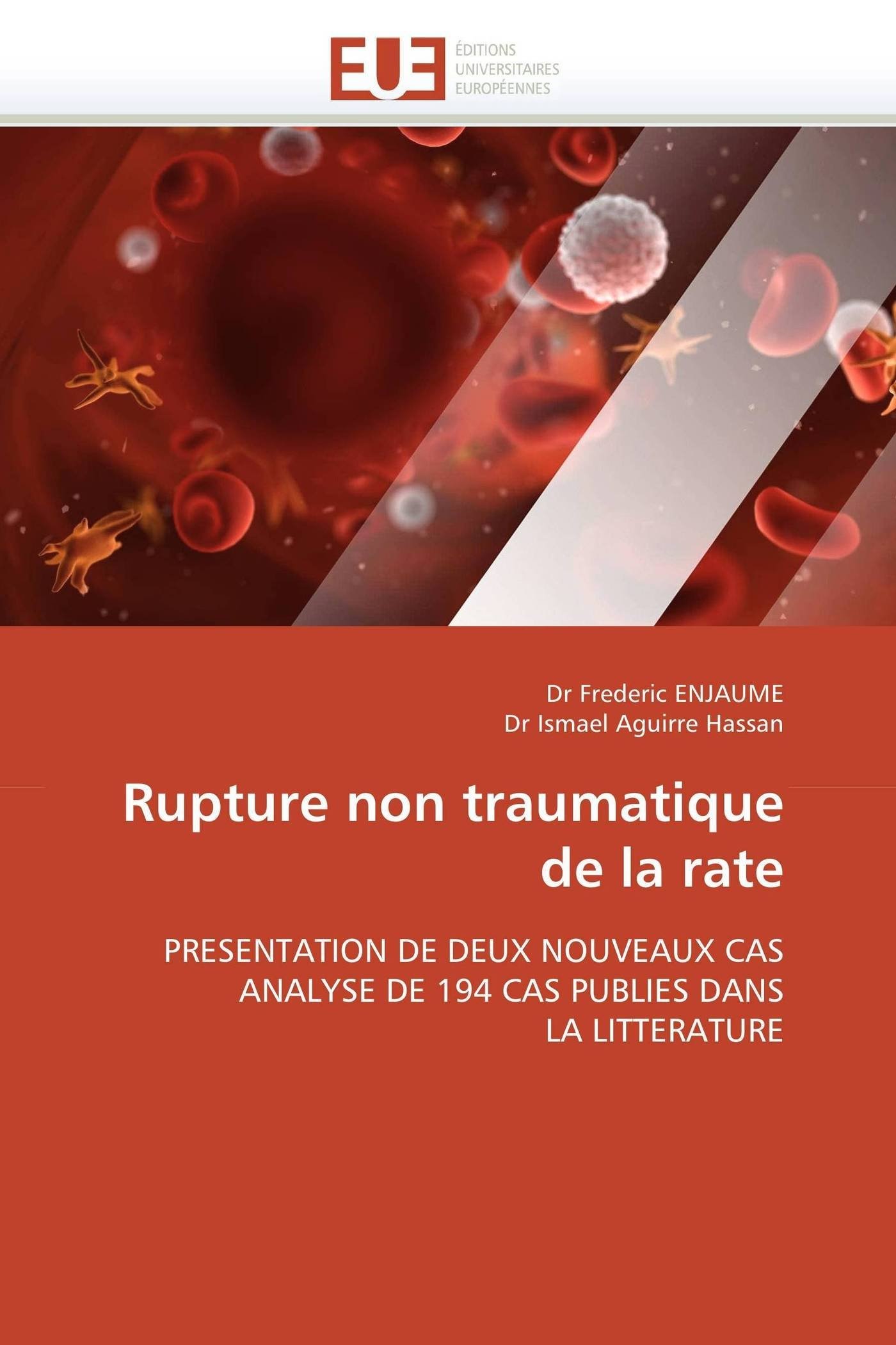 Rupture non traumatique de la rate: PRESENTATION DE DEUX NOUVEAUX CAS ANALYSE DE 194 CAS PUBLIES DANS LA LITTERATURE (Omn.Univ.Europ.)