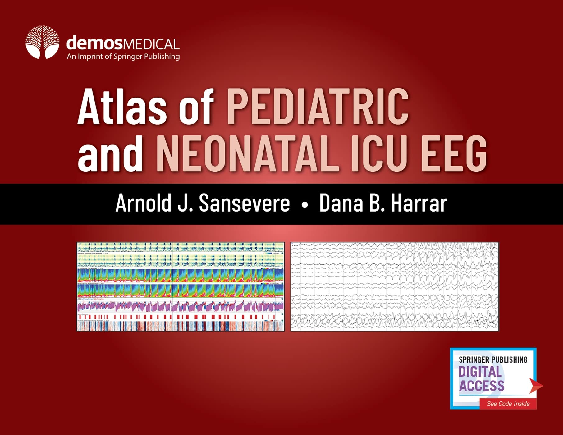 Springer Publishing Co Inc Atlas of Pediatric and Neonatal ICU EEG