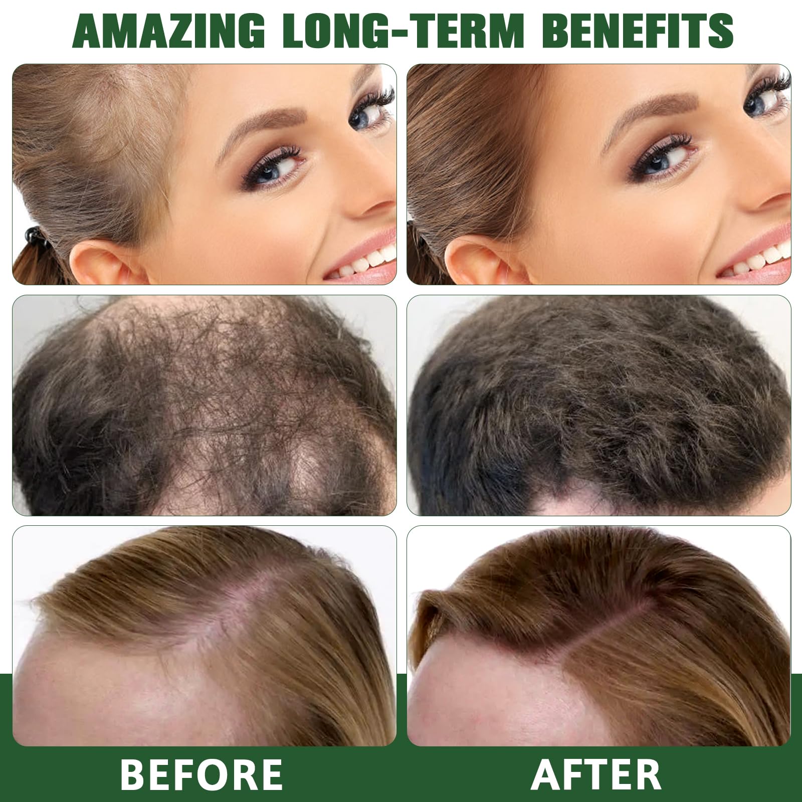 Lehit Complejo Biológico + Queratina Ampollas Masaje Intensivo Hidrofluido Contra La Caída Del Cabello | Biological Complex + Keratin Blisters Intensive Massage Hydrofluid Against Hair Loss 12 X 13 Ml