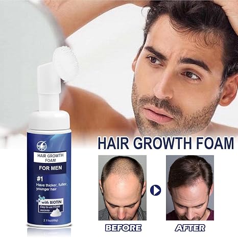 Hair Growth Foam for Men Renewhair-X Hair Growth Serum Foam Hair Regrowth Foam Anti-Hair Loss Foam Hair Treatment For All Hair Types (2pcs)