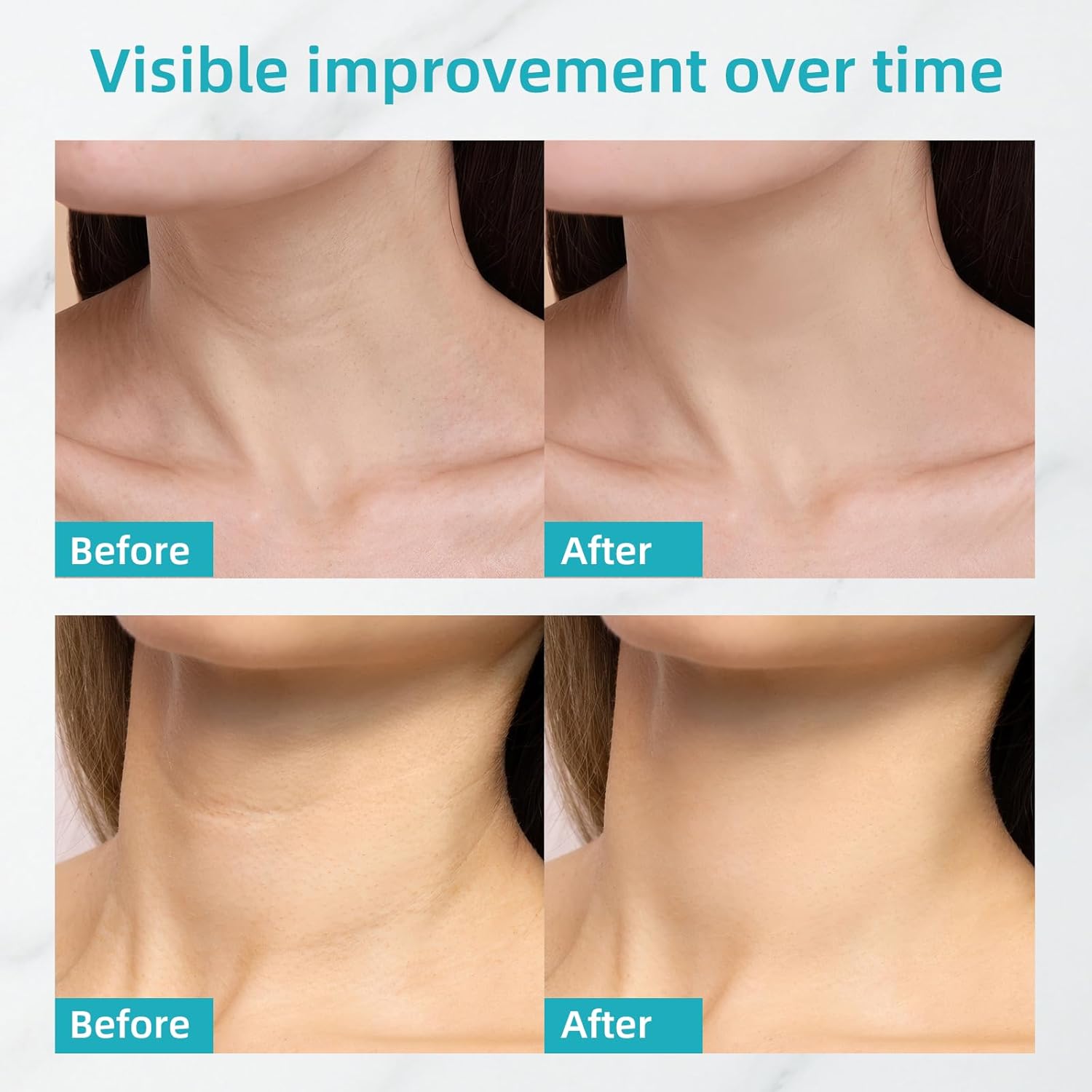 Girl's side Neck Firming Cream with Niacinamide & Bifida Ferment - Hyaluronic Acid, Caffeine, Ceramide Moisturizer to Minimize Fine Lines, Tighten Neck & Chest Skin, 1.7 fl oz / 50 g - Image 4