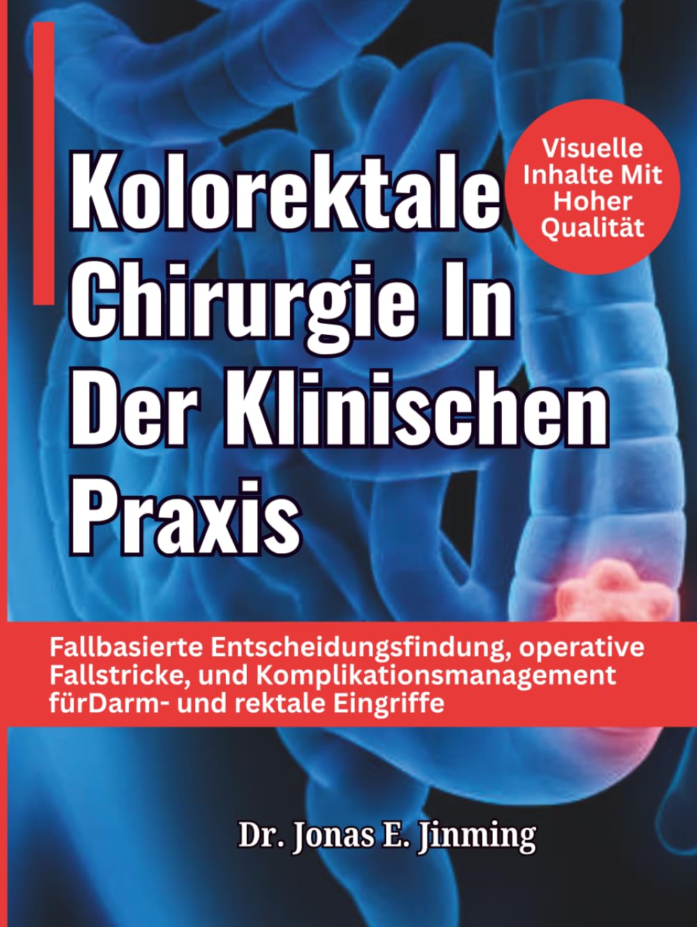Kolorektale Chirurgie In Der Klinischen Praxis: Fallbasierte Entscheidungsfindung, operative Fallstricke, und Komplikationsmanagement fürDarm- und rektale Eingriffe