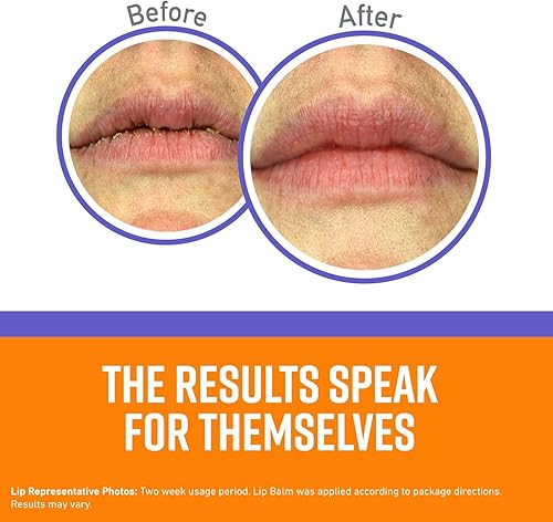 Miniatura 6 de O'Keeffe's Paquete combinado de tratamiento nocturno que incluye crema de manos de tratamiento nocturno para manos trabajadoras, tratamiento