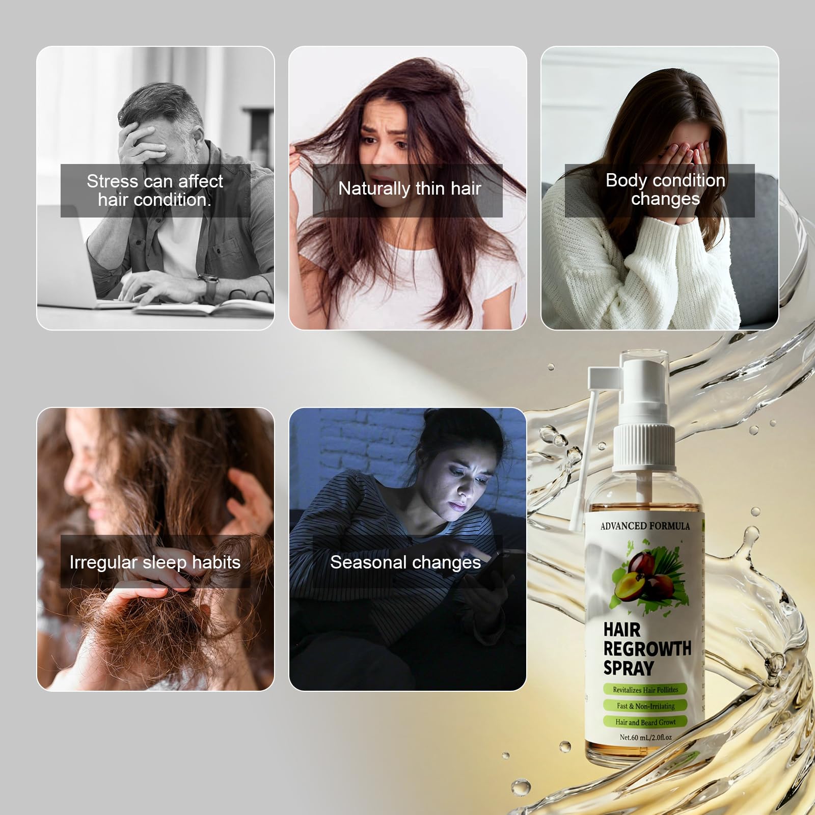 Sérum Crecimiento Cabello Anticaída,con Romero,Batana,60ml | Aceite de Ricino Orgánico&Biotina, para Mujer y Hombre,Fortalece y Mejora la Densidad Capilar,Cuero Cabelludo Sensible,Barba