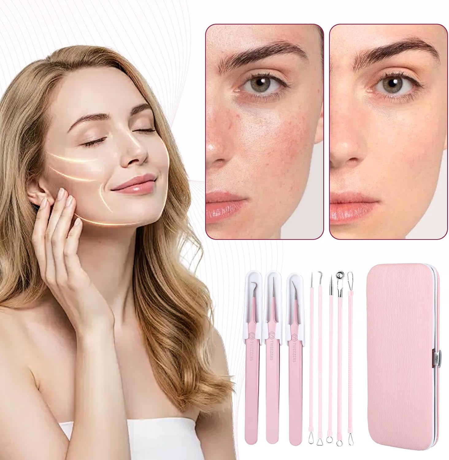 8 Piece Blackhead Tweezers Pimple Popper Tool Kit Complete Stainless Steel Blemish Removal Kit with Leather Mirror Box Home Use Facial Tools for Pimple and Blackhead Extraction (Bean Pink)