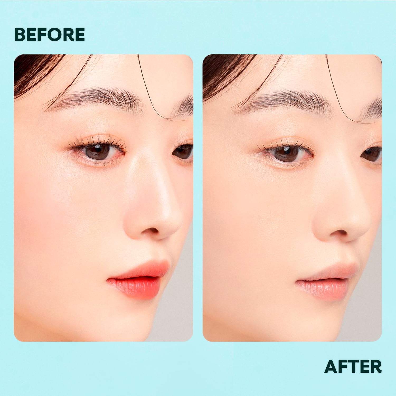 Micellar Water, Gentle Facial Cleanser & Makeup Remover for Adults, Cleansing & Moisturizing, Suitable for All Skin Type, Natural Ingredients, Postbiotics, Panthenol 8.45 Fl. Oz, 1 Count - Image 5