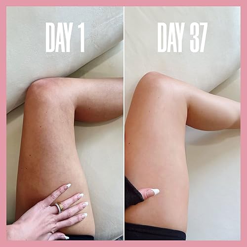 Miniatura 8 de MAELYS THE BOTY, MUSLO Y BRAZO