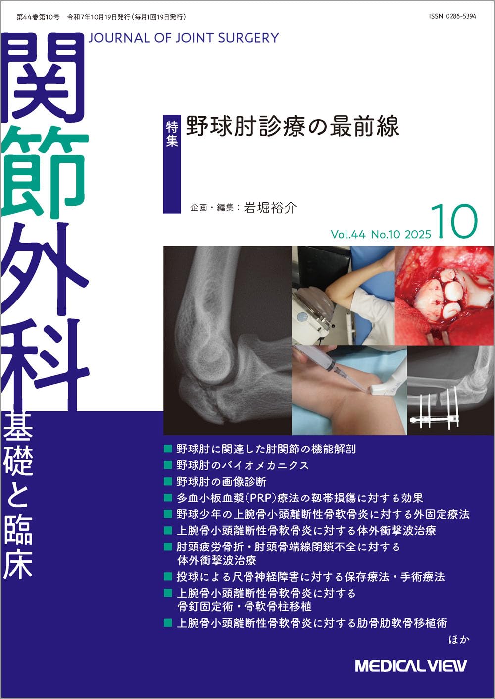 関節外科 -基礎と臨床 2025年10月号 特集：野球肘診療の最前線 | 岩堀