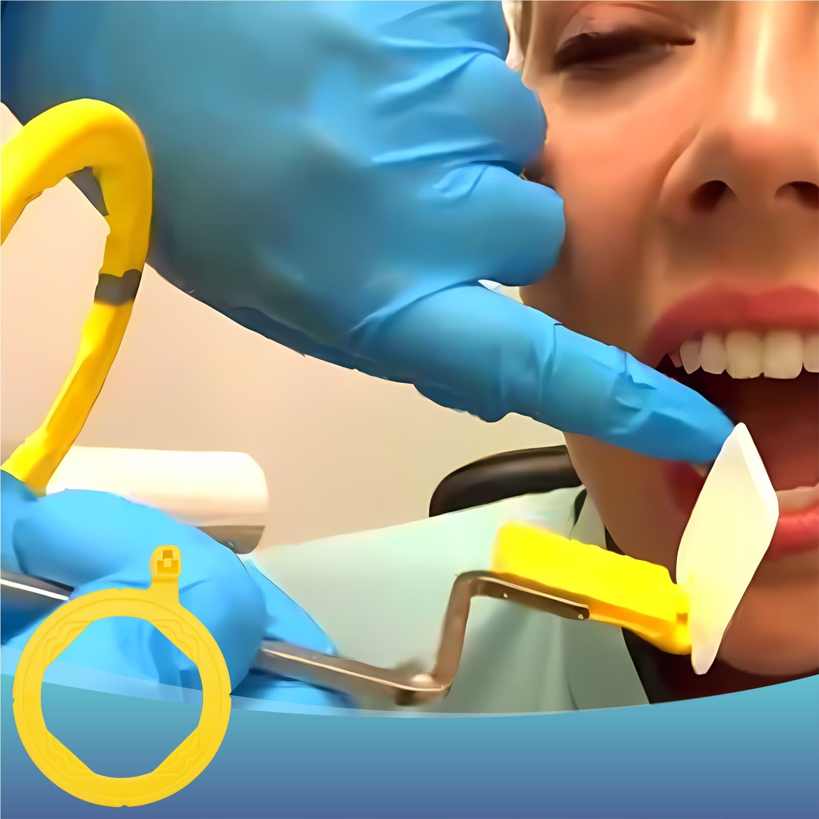 Dentale Röntgen-Positionierungsindikatoren, Zubehör für intraorales Filmpositionierungssystem, selbstoklavierbar, 10 Stück (gelber Rückenring)