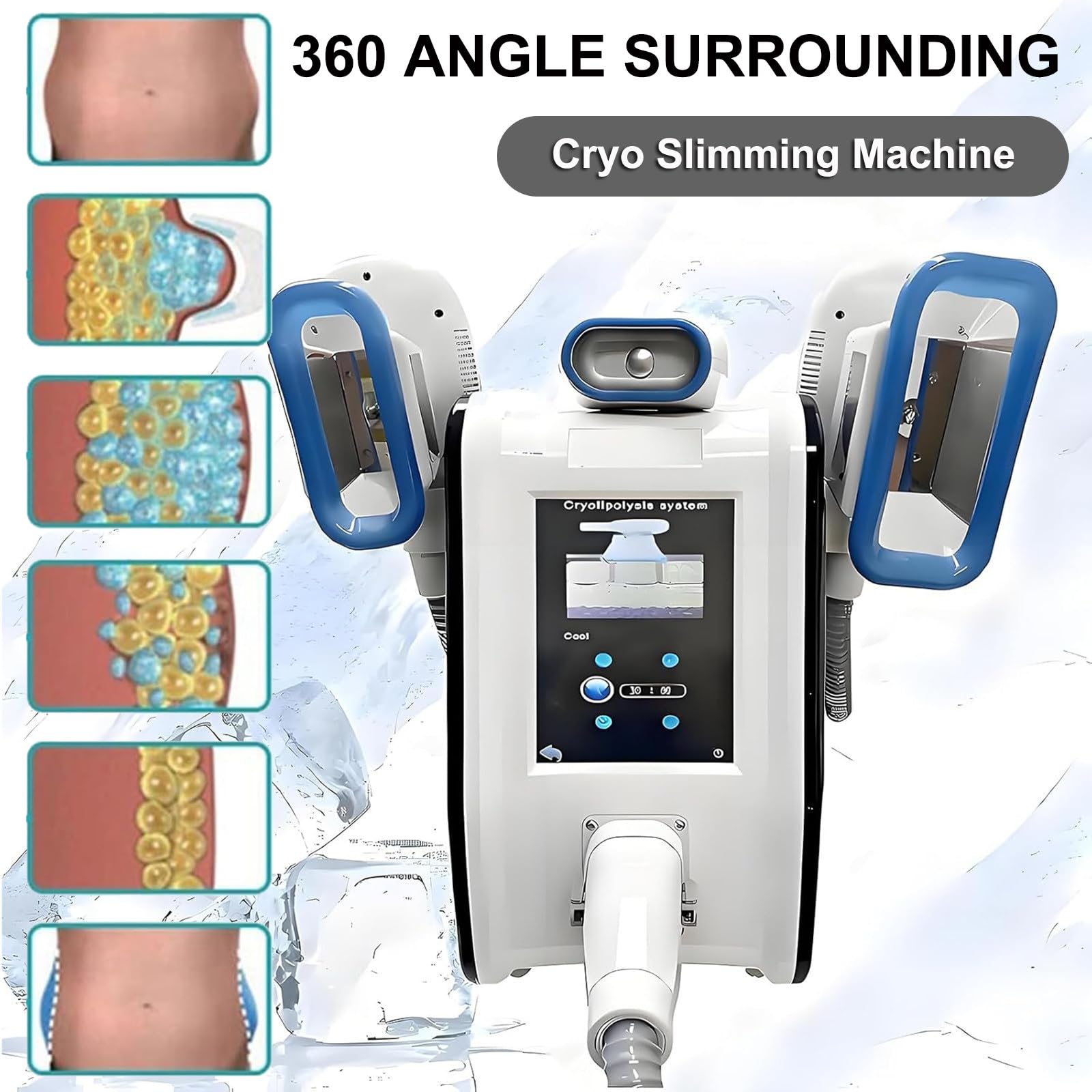Dispositivo per Modellamento del Corpo, Dimagrimento E Lipolisi, Macchina per Congelamento del Grasso, Crioterapia a 360° Macchina, Massaggiatore per La Rimozione della Cellulite