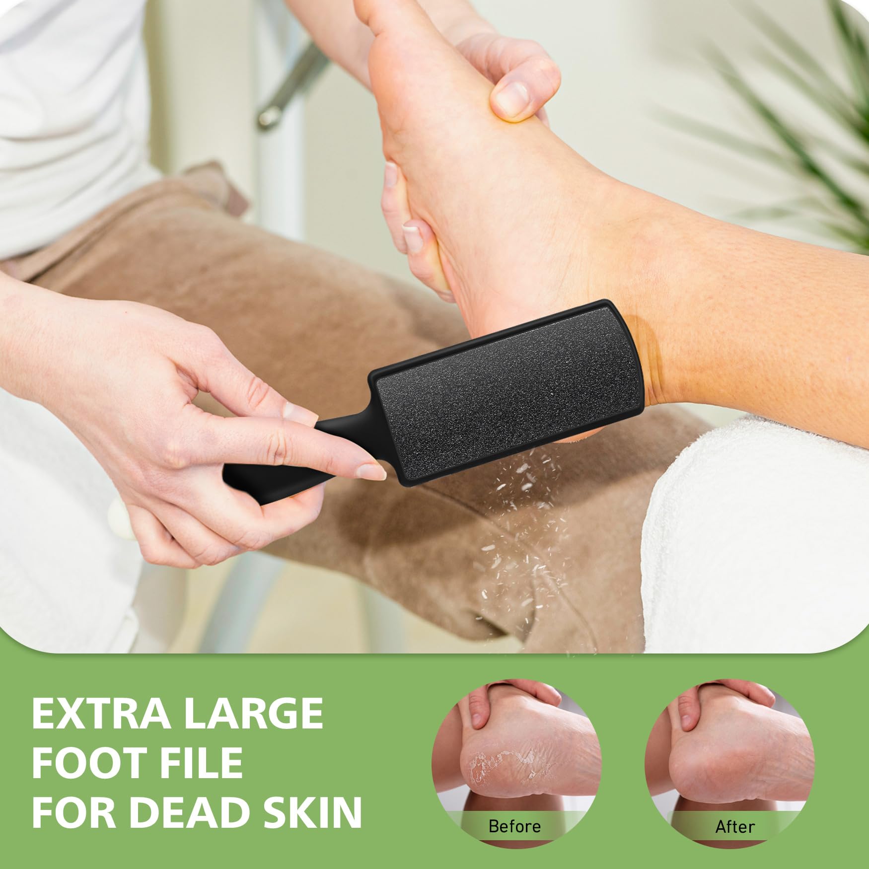 BALUCA Limas de pie removedor de callos de acero inoxidable y lima de pies de doble cara, herramientas profesionales de pedicura premium para el cuidado de los pies, quitar la piel dura, color negro