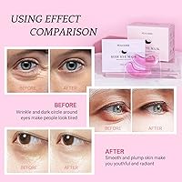 Vista 4 de Under Eye Patchs - Máscara de ojos rosa para ojeras e hinchazón, bolsas antiarrugas para ojos, 30 pares