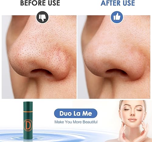 Miniatura 7 de Herramienta removedor de puntos negros, kit de eliminación de acné para manchas, estallido de puntos blancos, 7 piezas de eliminación de espinillas