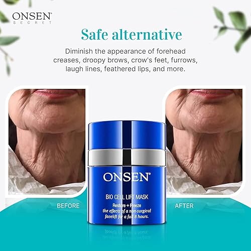 Miniatura 4 de Onsen - Rejuvenecimiento facial antiarrugas no invasivo, suaviza las arrugas, repara la piel, máscara secreta de grado profesional para el cuidado
