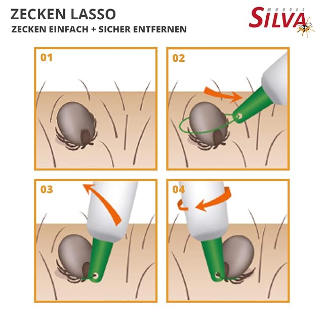 Foto 3 de 6 de Silva Zeckenlasso - Eslinga de garrapatas fiable y segura para eliminar garrapatas, para personas, perros…