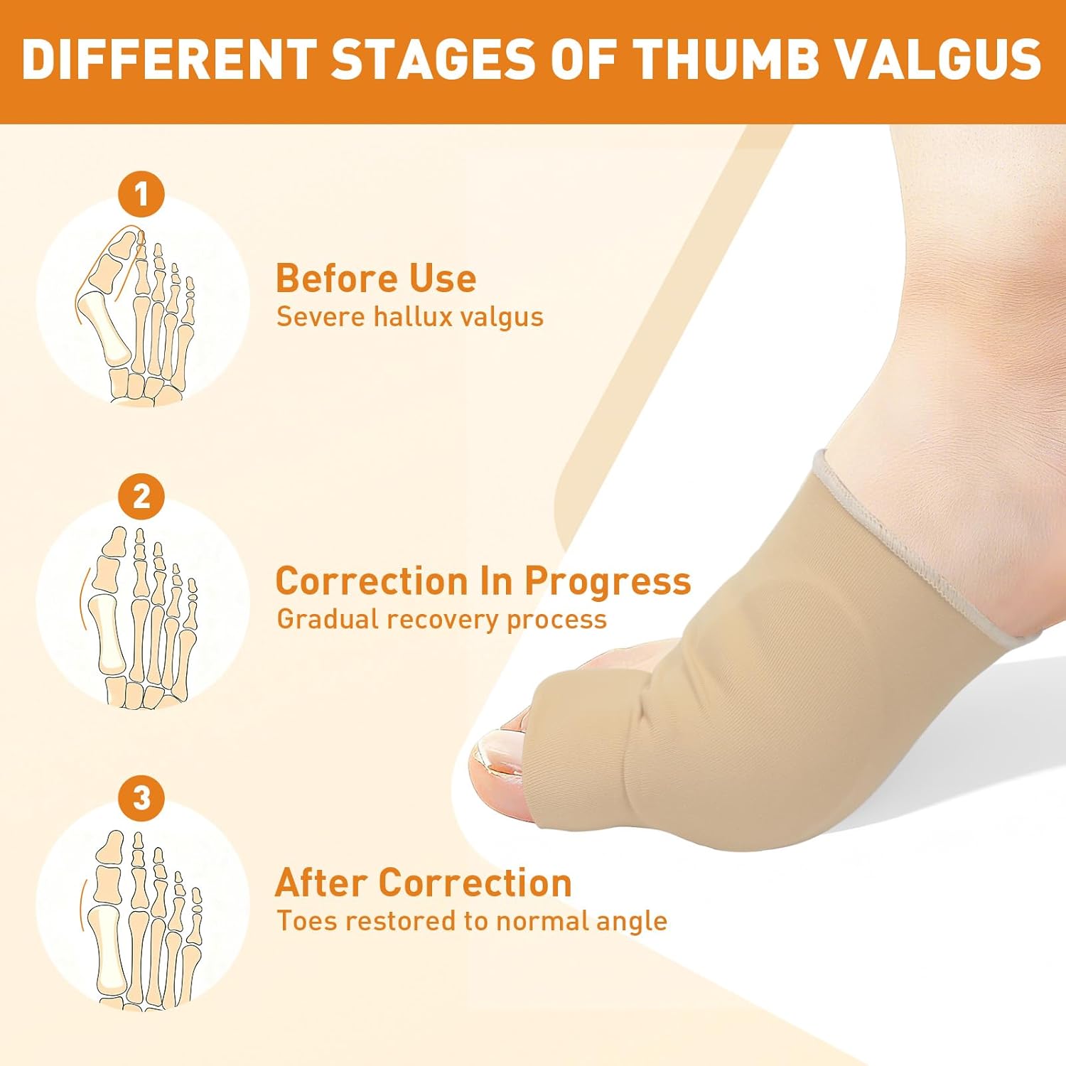 4Pcs Bunion Corrector for Women Big Toe, Big Toe Separators Non-Slip & Washable, Toes Straightener, Hallux Valgus Pain Relief Bunions Correction with Splint & Pads (Baige) - Image 5