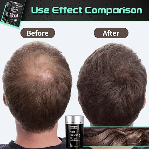 Miniatura 3 de Fibras capilares para cabello fino (marrón medio)  Espesante de cabello fino para mujeres y hombres  oculta la pérdida de cabello en 15 segundos