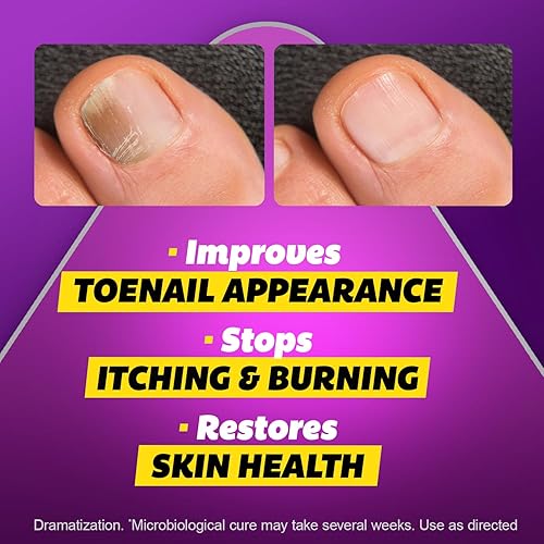 Miniatura 4 de SILKA Líquido antifúngico Max Strength para la salud de las uñas de los pies, con aplicador de cepillo, trata hongos, tiña y pie de atleta, restaura