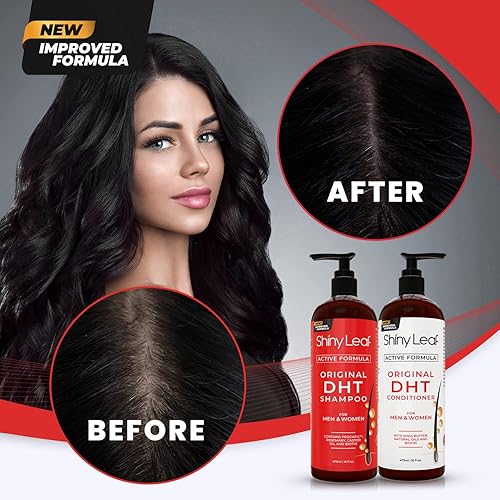 Miniatura 6 de DHT Blocker Champú y acondicionador para pérdida de cabello con biotina para hombres mujeres tratamiento antipérdida de cabello para adelgazar el