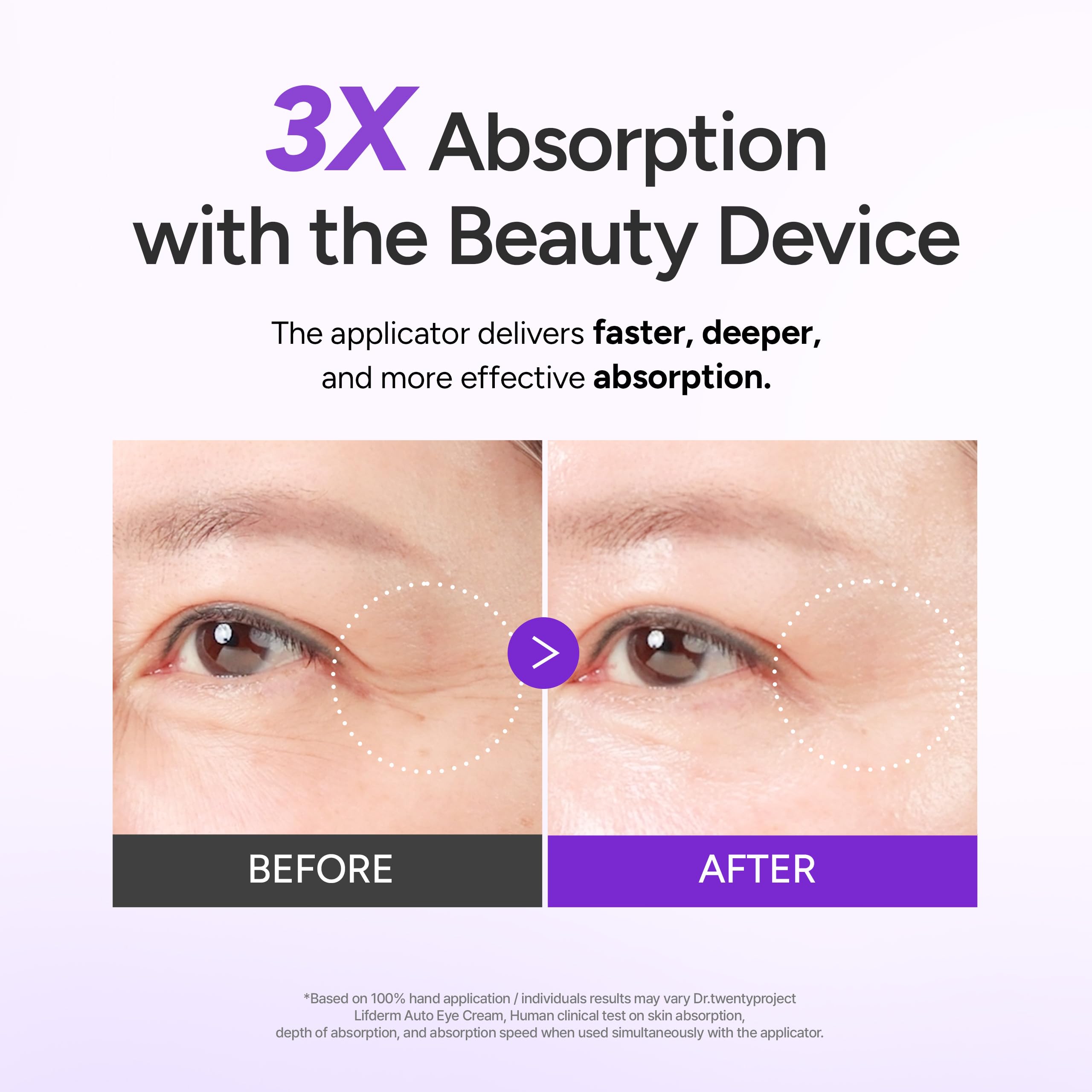 Amazon.co.jp: [Dr.twentyproject] リプダム オートアイクリーム 20ml