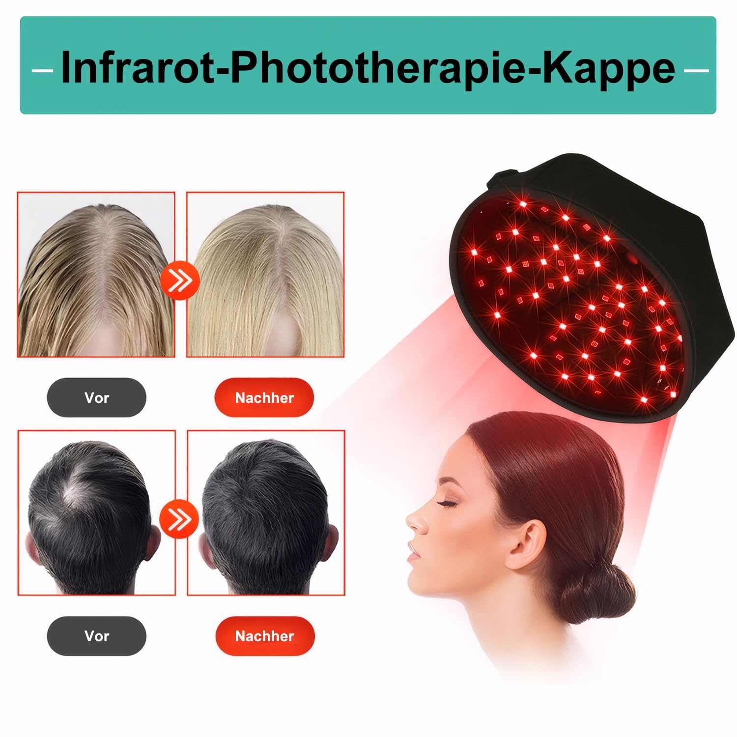 Rotes Licht Therapie Cap für Haarwachstum, Infrarot-Licht Haarwachstum Gerät, 120 LEDs, 660nm 850nm Wellenlängen für Männer und Frauen, Einheitsgröße, verkabelt