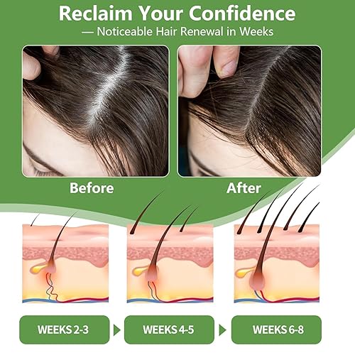 Miniatura 5 de Máscara capilar Batana para el crecimiento del cabello para mujeres y hombres