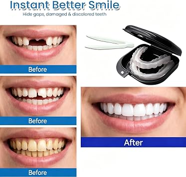 Adjustable Instant Temporary Veneers, Natural Upper Lower False Teeth Cosmetic Cover for Men Women, Black