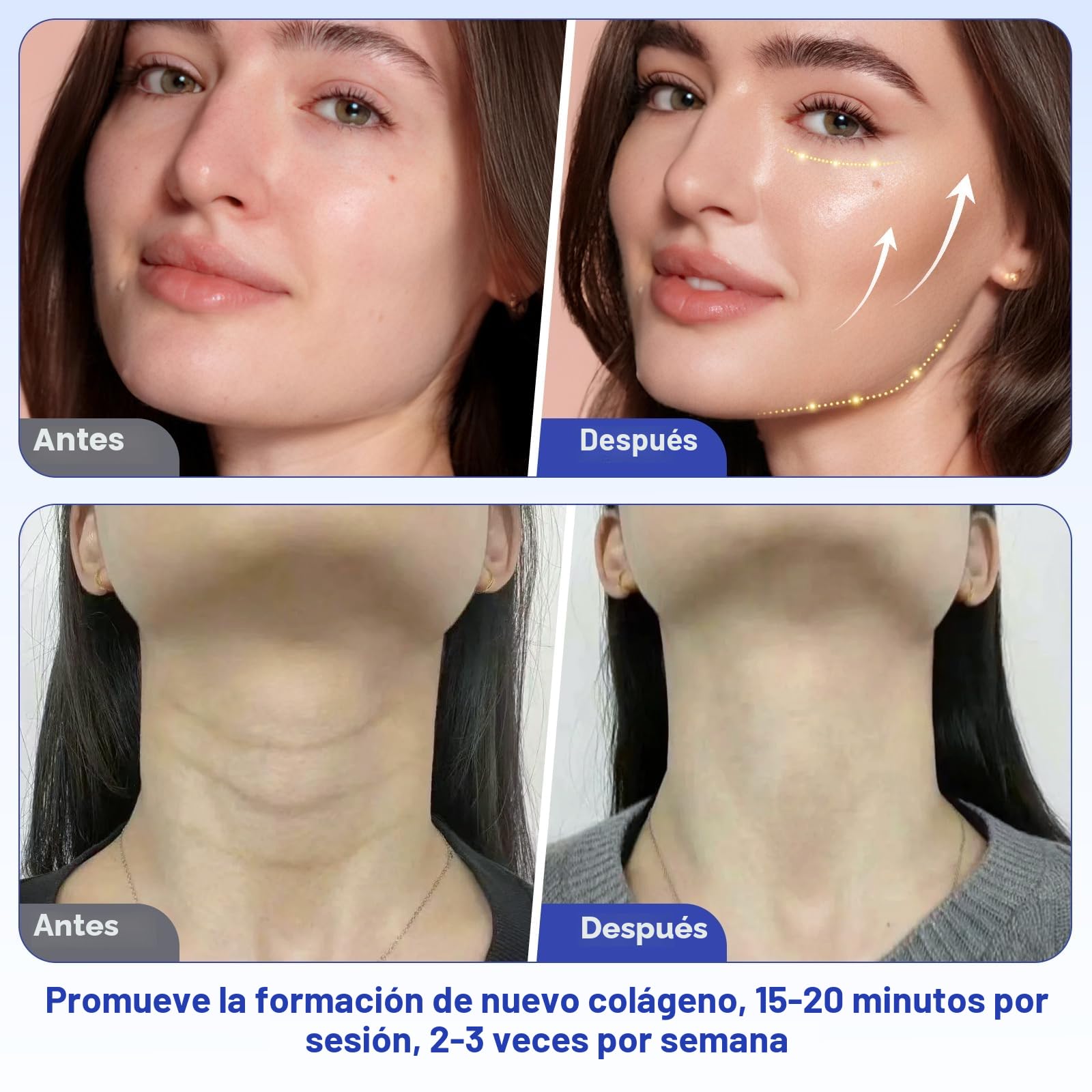 Dispositivo de Masaje 40K Cuatro en Uno, Equipo de Radiofrecuencia para Cuidado Facial y Corporal en el Hogar