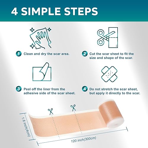 Miniatura 6 de Hojas de silicona para cicatrices, cinta de silicona para cicatrices (rollo de 1.6 x 120 pulgadas - 9.8 ft), cinta de cicatriz para cicatrices