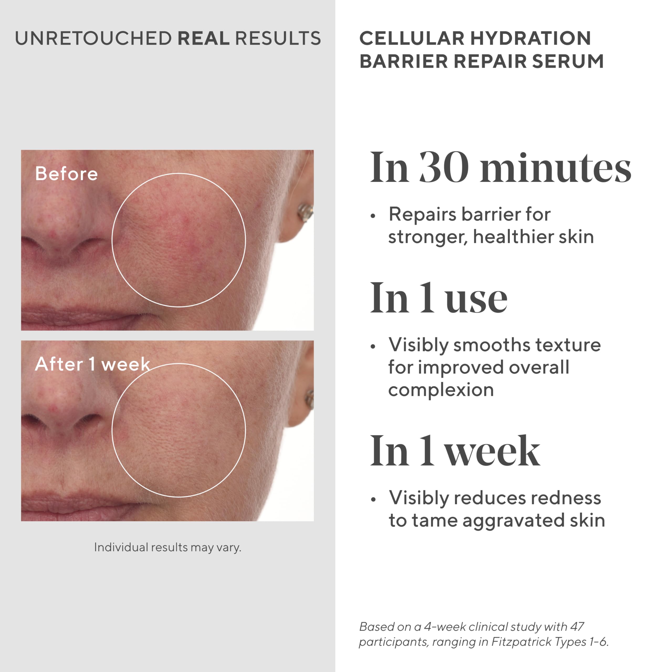 Murad Cellular Hydration Barrier Repair Serum – Hydrating Serum with Hyaluronic Acid, Bilberry, and Peptides for Strengthening Skin Barrier and Calming Redness – 0.5 Fl Oz