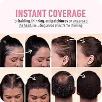 Vista 5 de BOLDIFY Polvo de línea capilar – Color de cabello para retoque de raíces para cobertura de canas, polvo para el cabello que oculta las zonas calvas