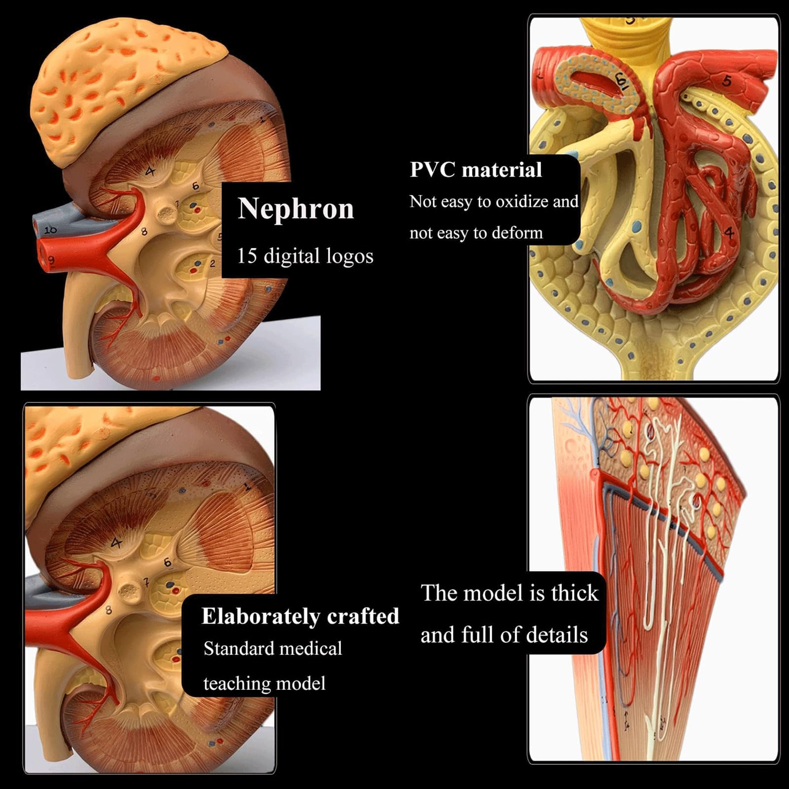 Anatomia Umana Organi Rene Rene Anatomia Macroscopica YouTube