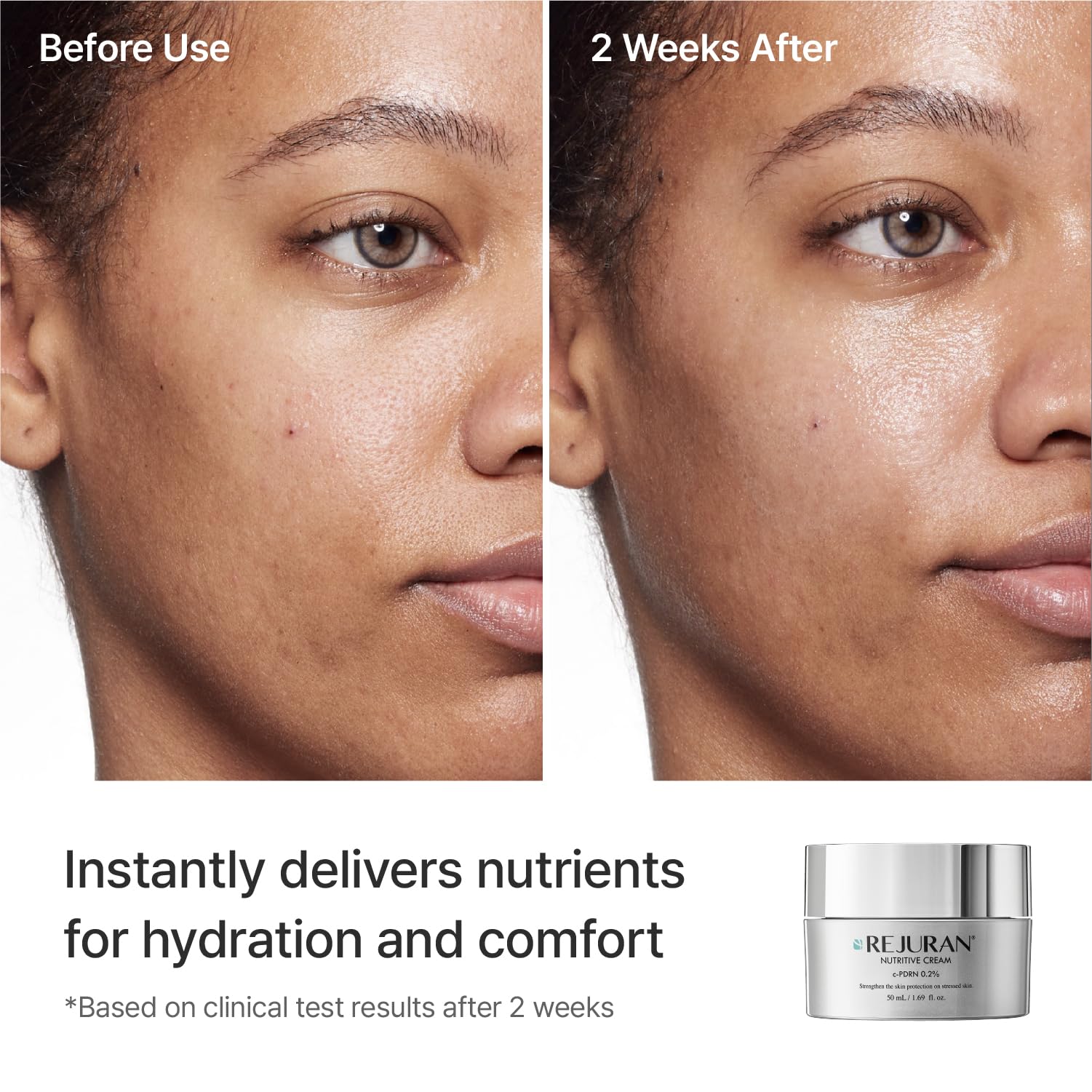 REJURAN Nutritive Cream with c-PDRN Salmon DNA Moisturizer