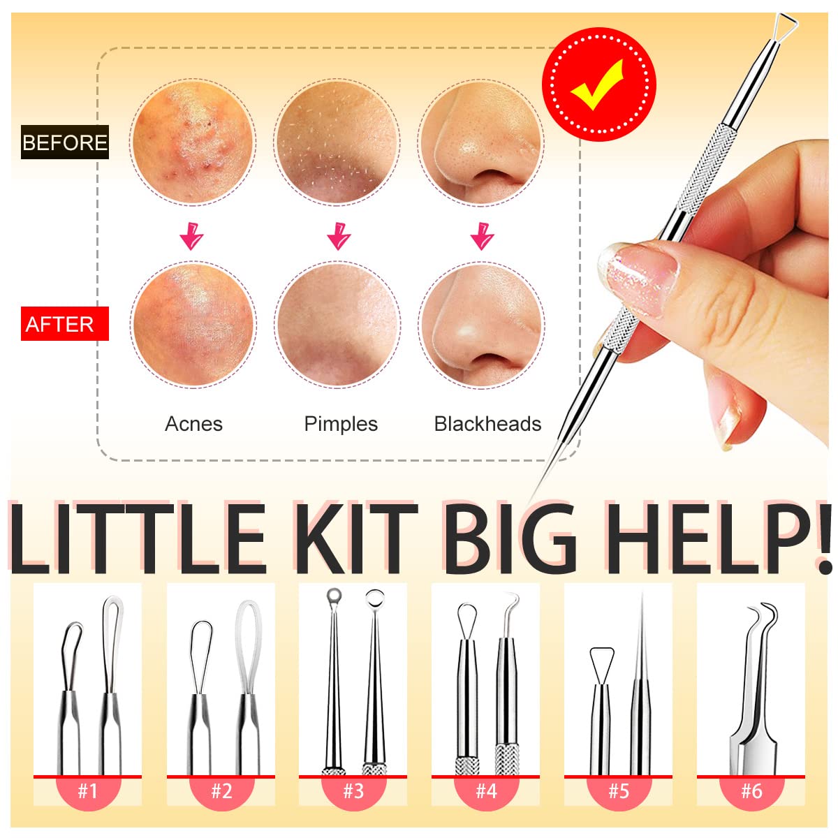 Blackhead Remover Tools, Pimple Popper Tool Kit, 6 Pack Professional Comedones Extractor Acne Removal Kit for Blemishs, Whitehead Popping, Zit Removing for Nose Face - with Organized Case : Beauty & Personal Care