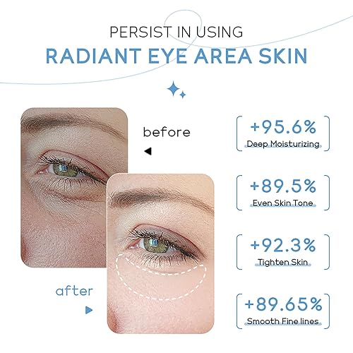 Miniatura 5 de ARAKY - Crema de leche para debajo de los ojos, triple rollo y brilla la piel alrededor de los ojos, suero de ojos para opacidad, sequedad, líneas