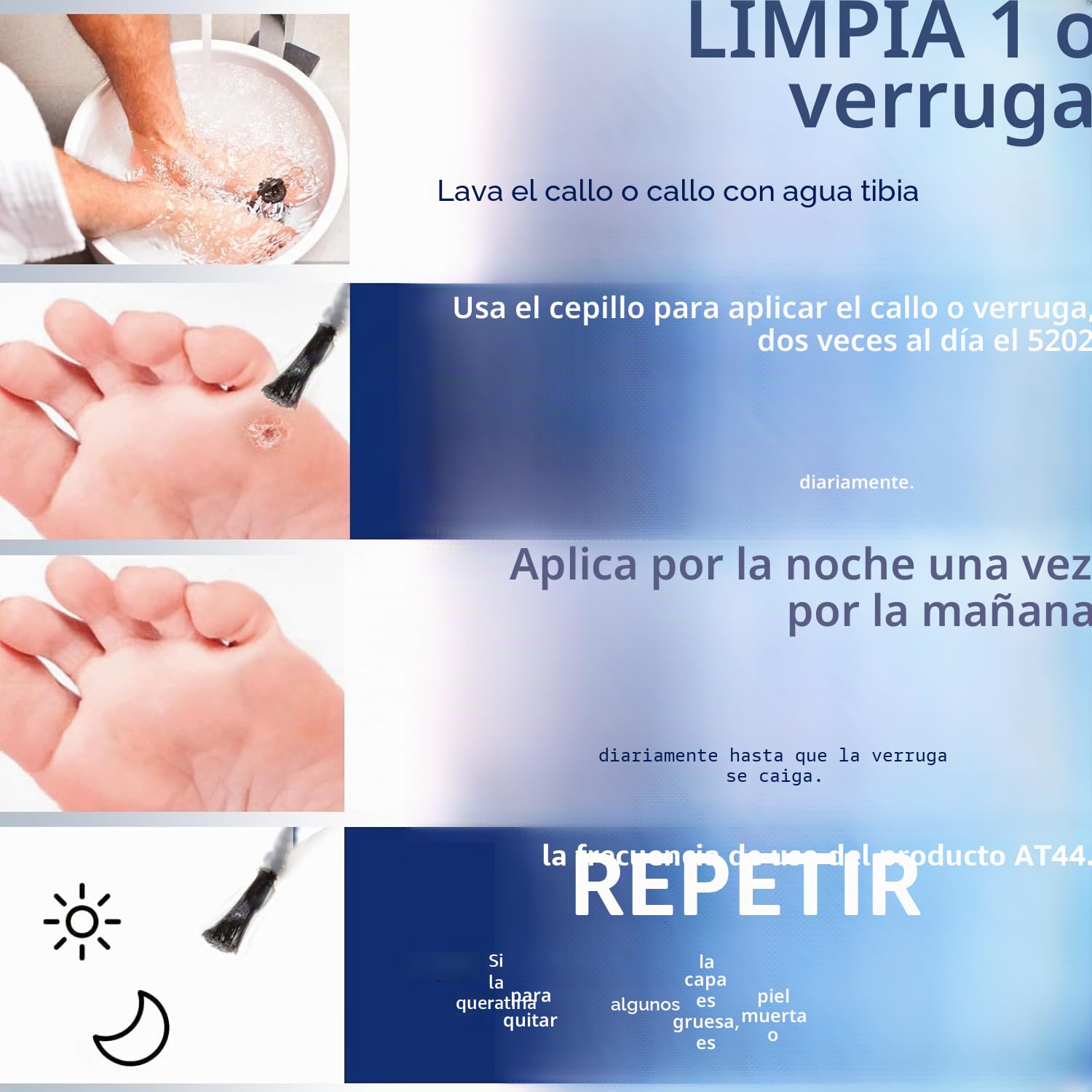 Removedor de Maíz con Veneno de Abeja, 20 ml Máxima Potencia, Eliminador de Callos Líquido para Pies, Acción Rápida, para Adultos, Personas Mayores, Adolescentes, Corredores, Senderistas