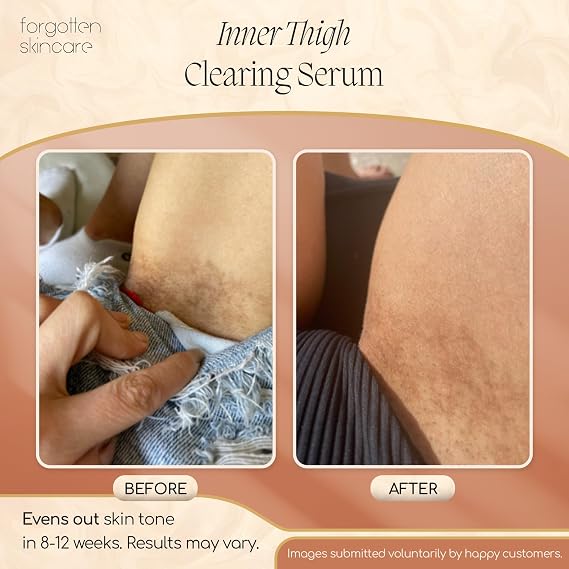 Forgotten Skincare Down Low Inner Thigh Serum For Bikini Line & Dark Spots