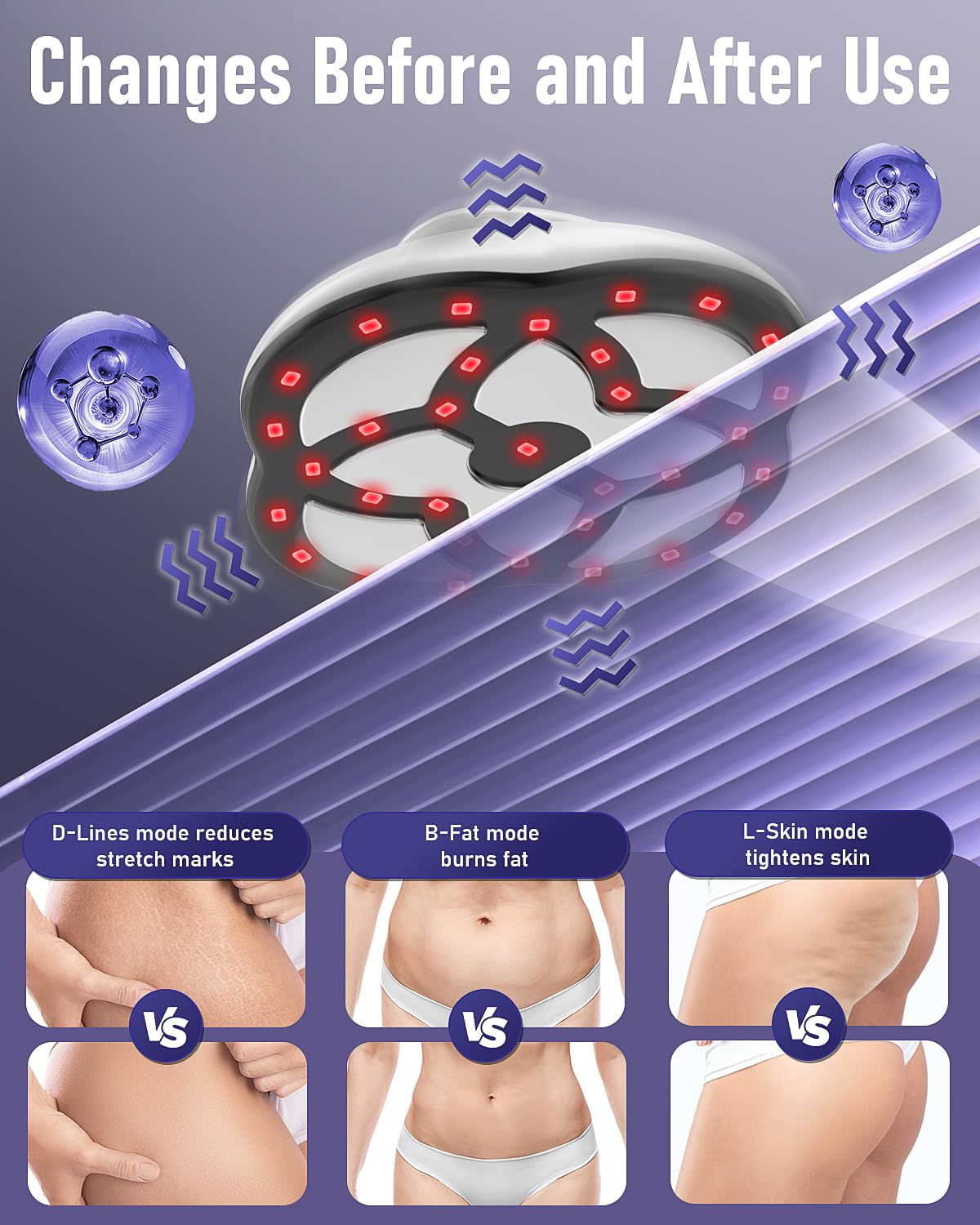 Cellulite Massager, 15 Adjustable Levels, 3 Working Modes